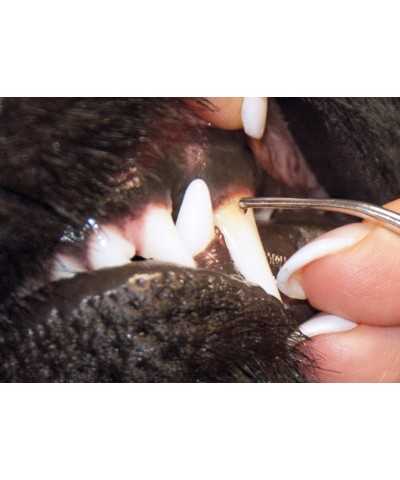 Strumento per la Pulizia Dei Denti Rimuovi Tartaro