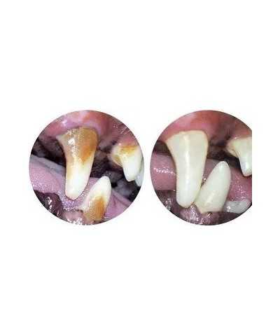 BalùDefend Dentifend